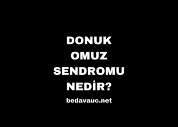 Donuk Omuz Sendromu Nedir? Nedenleri ve Tedavi Yöntemleri