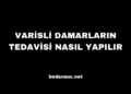 Varisli Damarların Tedavisi Nasıl Yapılır
